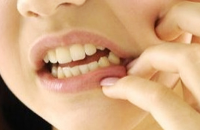 突發(fā)性、自發(fā)性的劇烈牙疼