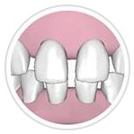 牙縫隙大 牙縫隙大