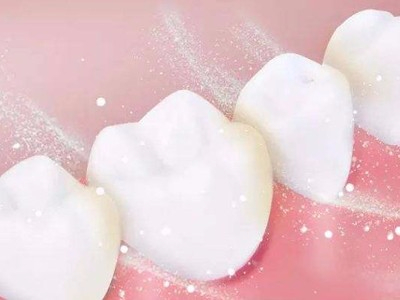 承德市這邊有哪家醫(yī)院能美白牙齒？惟德口腔牙齒美白您不錯的選擇