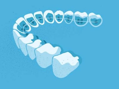 惟德口腔醫(yī)院口腔正畸好不好？